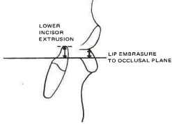 Manual Illustration